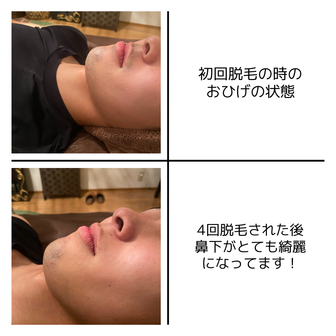 ダウンロード